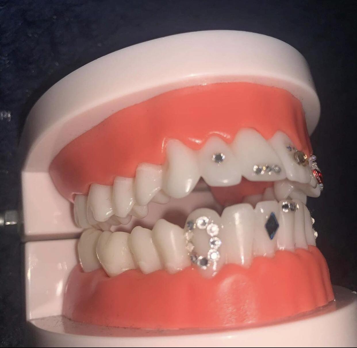 Window Tooth